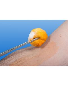 NOBA® gaasdepper ø4,5cm